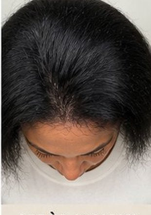 After using the product