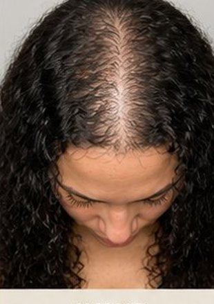 Before using the product