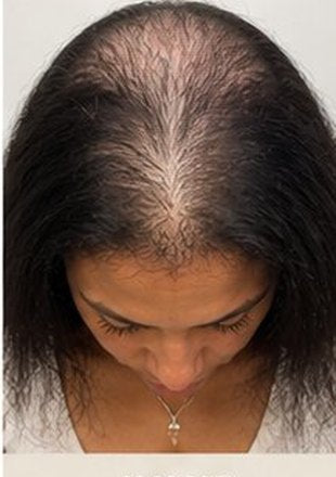 Before using the product