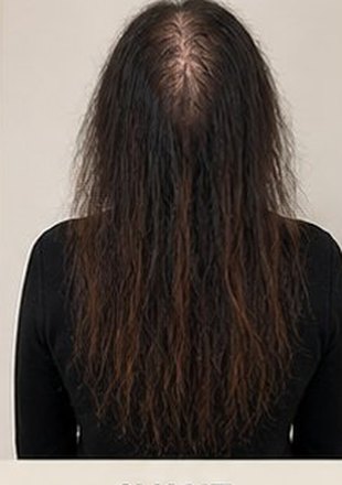Before using the product
