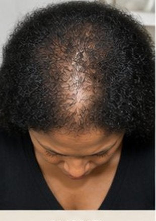 Before using the product